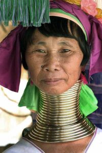 Figure 1. A Kayan (Padaung) woman in Thailand displaying her neck rings. The rings make the neck appear longer than the normal neck length.